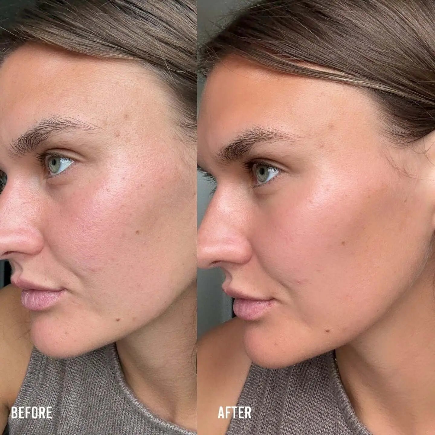 The Rainy Day Face Glow Set Sun Kiss